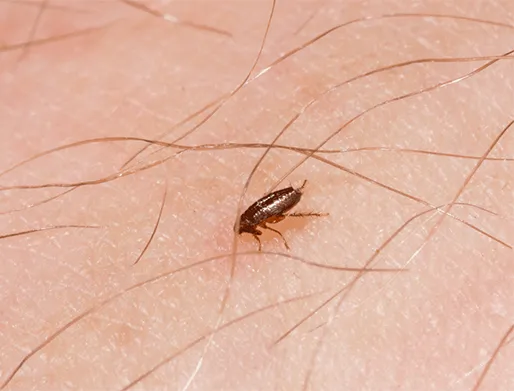 Dedetização de Pulgas na Granja Viana